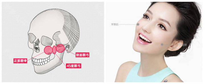 从生理学上解读,颧部是指人面部的一个部位,由皮