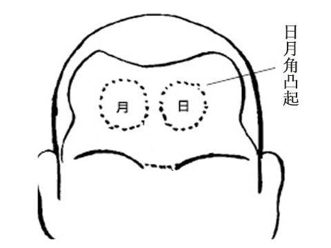 太阳骨突出面相图片