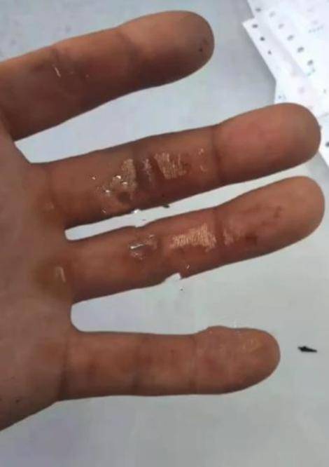  二驴夫妇真摊上事：售卖的山寨机发生爆炸 炸伤消费者(图2)