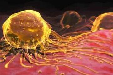 胡萝卜素|癌症最怕的5种碱性零食，告诉爸妈每天吃一点，预防癌症有奇效！