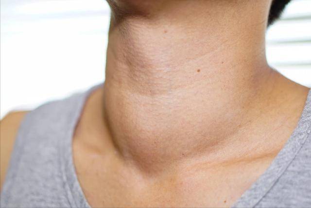 甲状腺失调身体遭殃身体出现5症状或是甲状腺报警