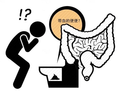 什么是长期慢性腹泻 64d142c18aba4e57928c75d588d4910e.png