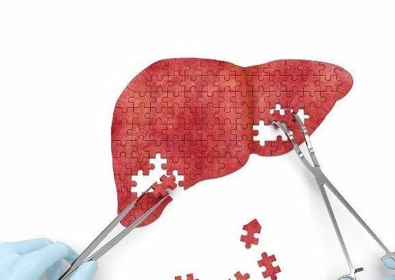 肝脏|肝脏发生肝硬化,6个症状会“提醒”你,越早去医院越好