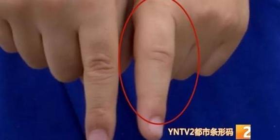 手指|幼儿园男童手被老师打肿，家长报警处理！结果……