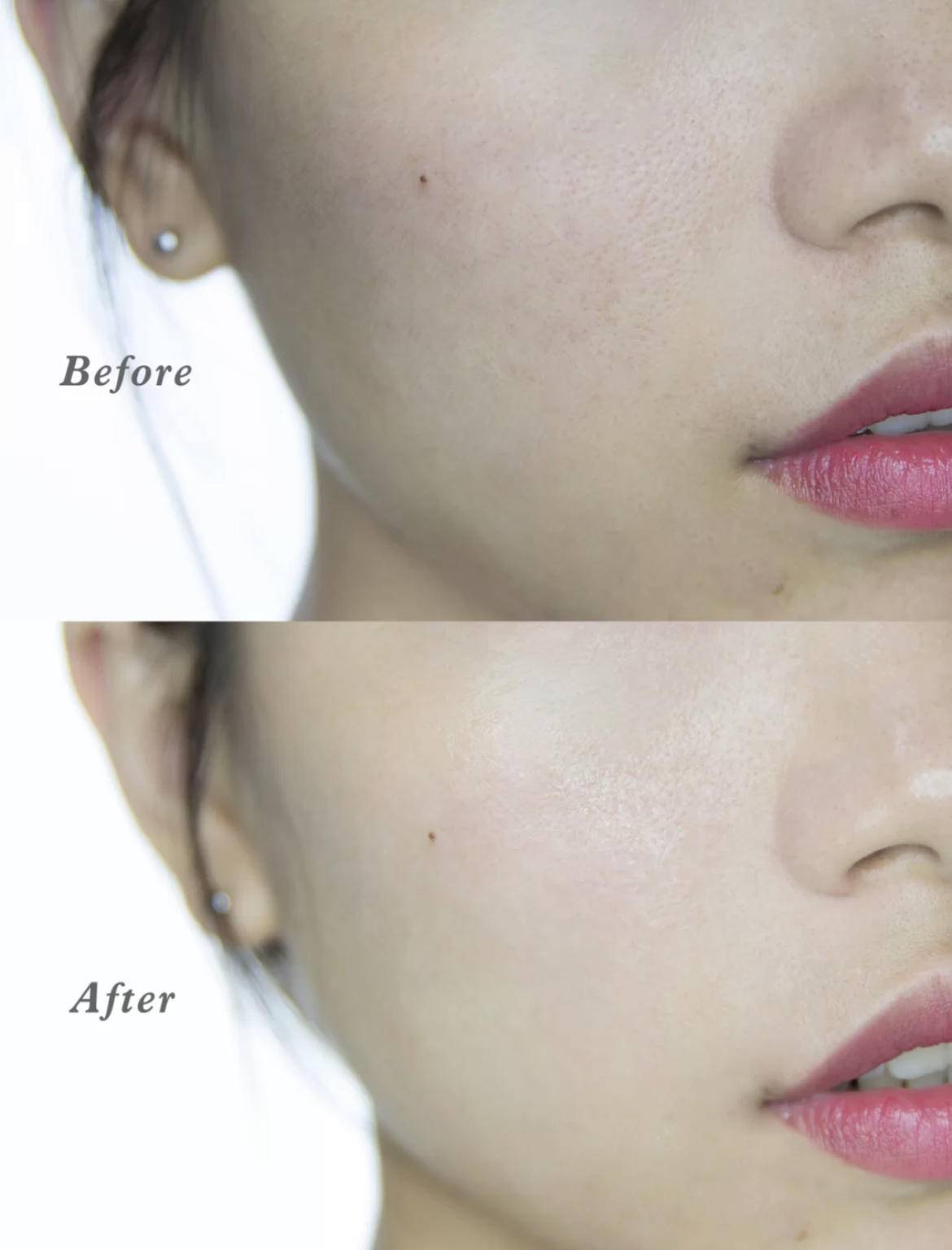 晒斑|这点没做好，脸上的斑肯定找上门