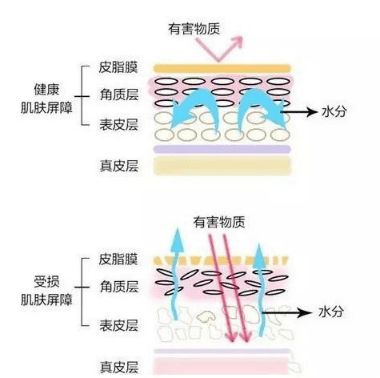 科普|moodrose科普|皮肤屏障：皮肤最重要的一条防线