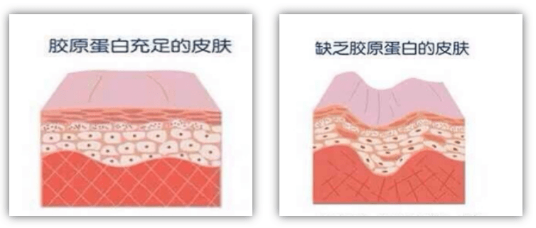 人体|紧致水润肌·养成术||胶原蛋白真的那么重要吗？