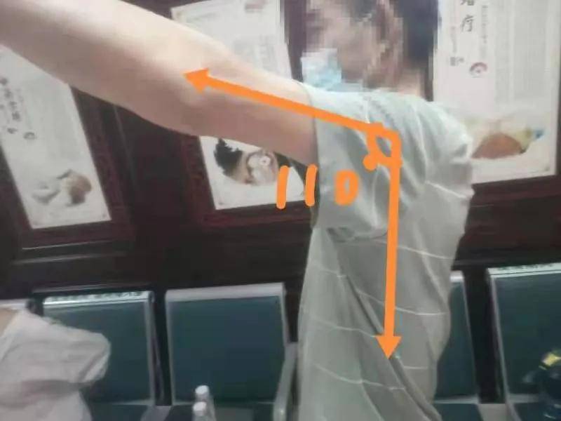 秒杀|小针刀 真神奇 一招 “秒杀”疼痛