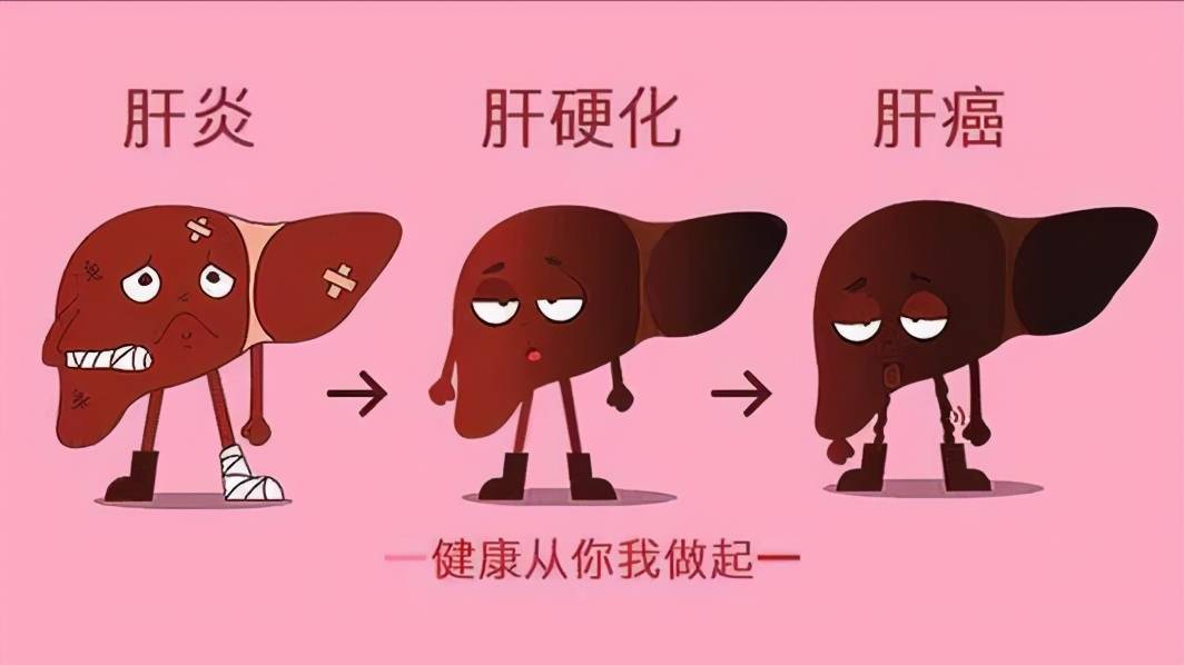 什么|乙肝患者要注意什么?这3点很重要,不能忽视