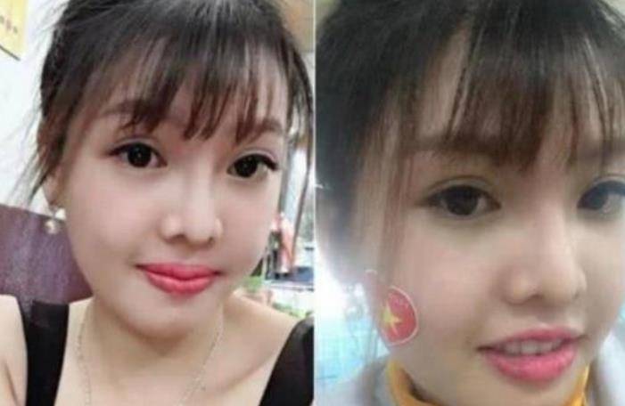 因为|越南女孩因长得丑遭嘲笑，整容后嫁给富豪，没成想孕期“现原形”