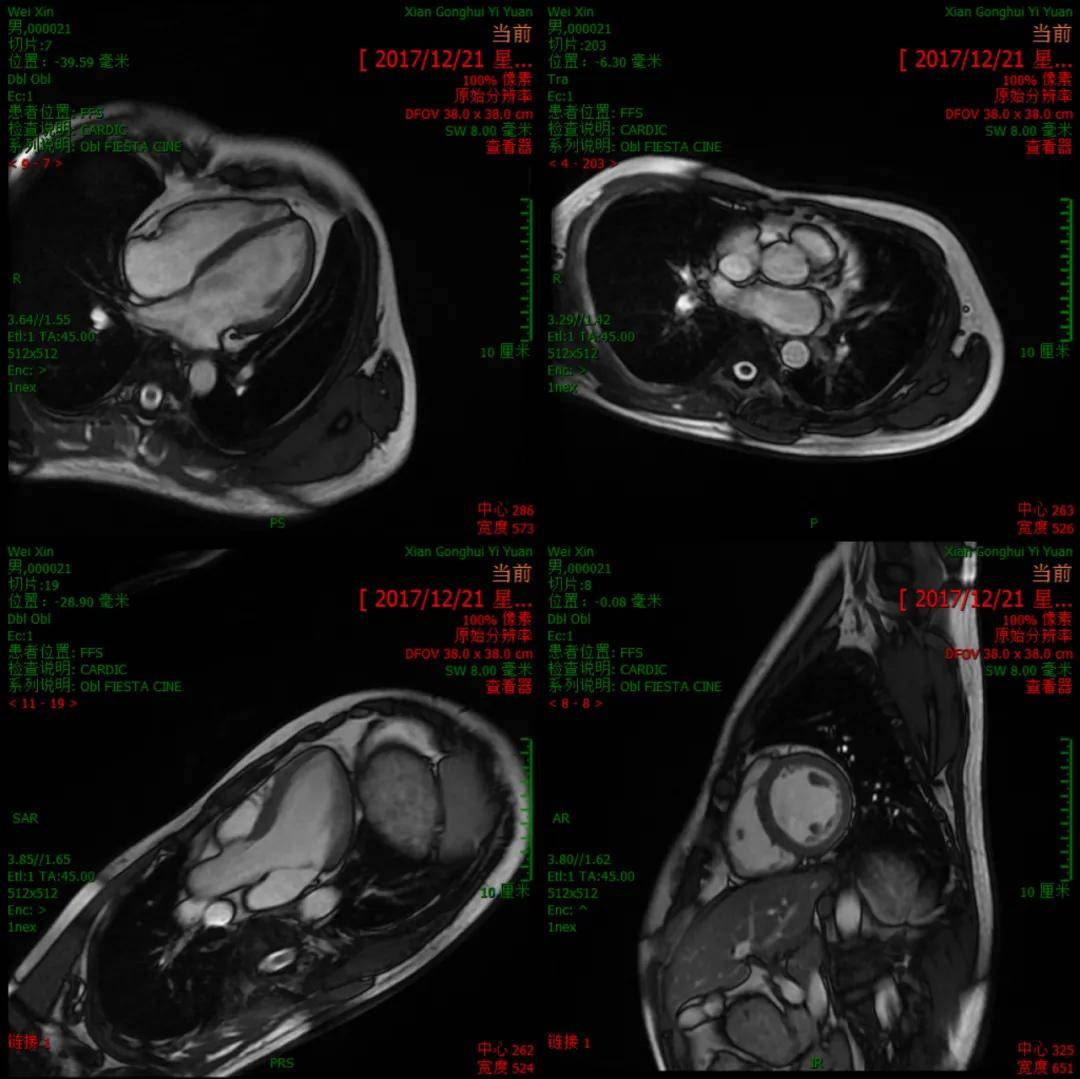 成像|【科室推荐】西安工会医院影像科