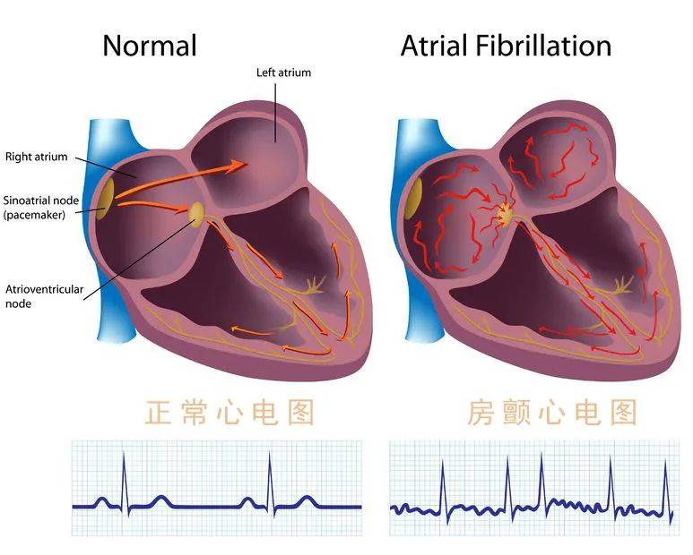 治疗|超过1000万人得这种疾病，一半以上患者竟不知其名