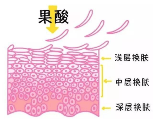 化学厂|怡玥|关于护肤品中的各种“酸”，你知道多少？