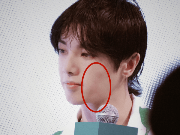 华晨宇被曝植发整容,十年容貌变化对比,锥子脸五官越来越精致