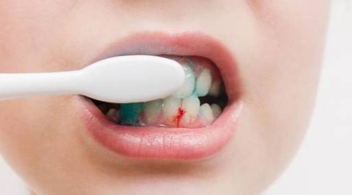 祸首|肝硬化的“祸首”被揪出，与饮酒无关，而是这种水果，要忌口