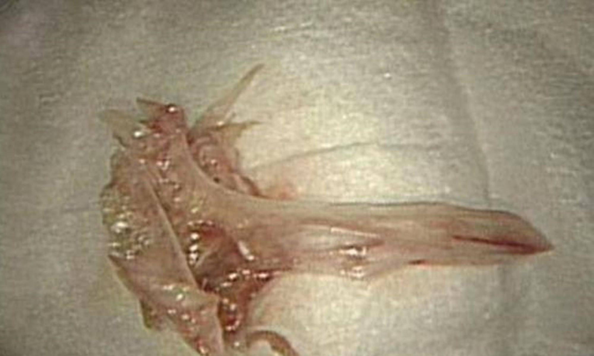 菲菲|父母眼中的“健康零食”，制作环境堪比垃圾场，父母至今蒙在鼓里