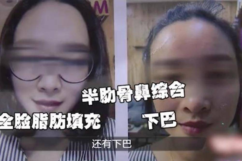 漂亮|女子为了追求变美选择整容，结果嘴巴整歪了，女子：让我怎么嫁人？