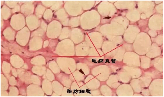 才有|关于脂肪填充脸能维持几年这事，做过了才有话说