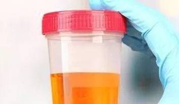 肾脏|尿酸增高的人，通常会有3种表现！提醒：2少、2喝、2吃，助控尿酸