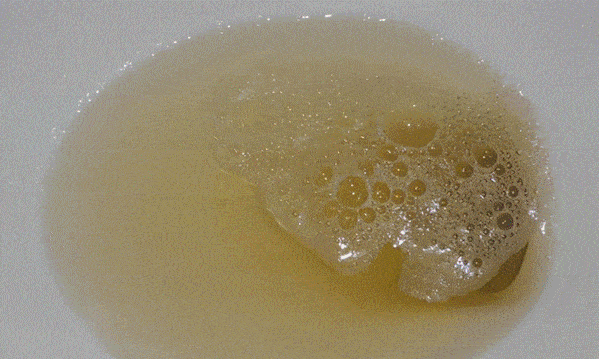 aaced9c601d04d80a19771afa1819179.gif