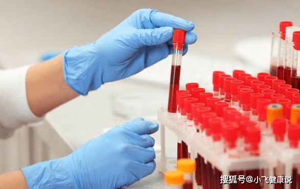 肾脏|肾脏硬化还有的救吗？做好此3点可稳住肾功能，尿毒症不会来袭