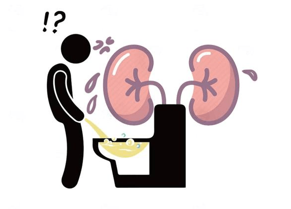 肾脏|肾脏病变，小便先知？提醒：小便4种异常，可能是尿毒症信号！