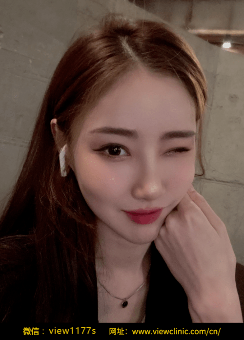 骨骼|必妩韩国地包天手术，趁年轻赶紧整早变美！