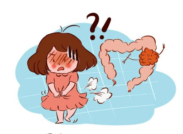 大便|大便“先硬后软”,是肠癌来临?医生:别慌,4个因素先搞清楚!