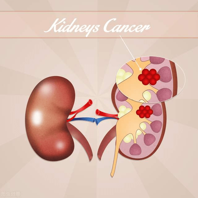 单位|肌酐过200，肾脏就危险了！医生：出现这些迹象要及时检查