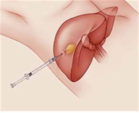 病毒|如果你体检发现两对半异常，知道有乙肝但不知该怎么办，请看此文