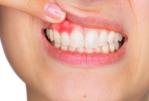 症状|糖尿病患者出现这些表现，说明血糖要失控了，不能忽视