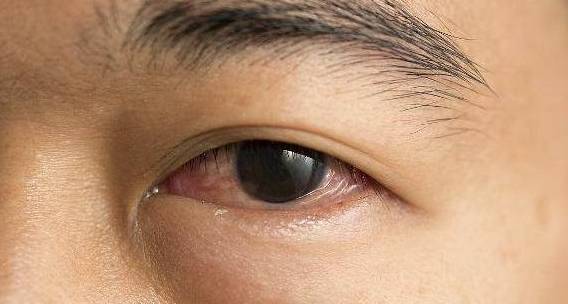 水果|身体有3个表现,说明糖尿病已经来了,控糖只需这3招!