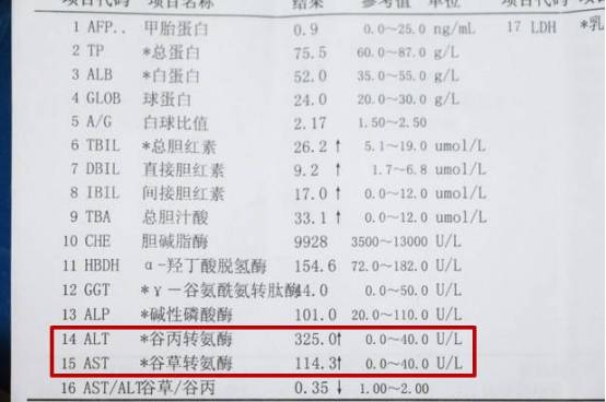 明明没有喝酒 转氨酶却一直上升 或许是这3个坏习惯害了你 肝脏