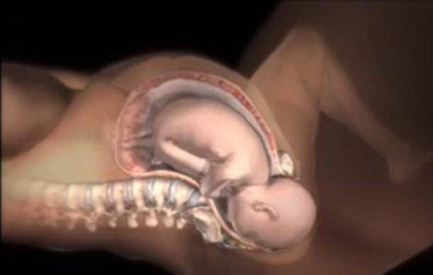 什么时候开始补充羊水 6e4824edcf1449e68cf29372a81c7f5d.jpeg