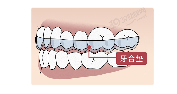 牙齿磨牙后垫图示图片