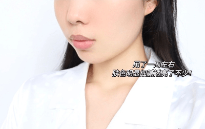 小玛|好用分享！今夏宝藏精华就是它，太惊喜了