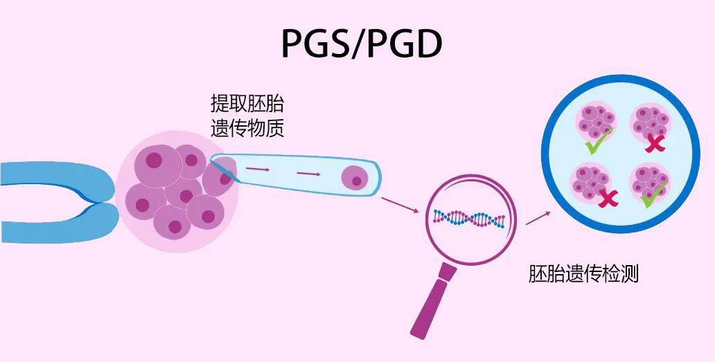 指定性别的试管要多少钱(指定性别的试管要多少钱呢)-第1张图片-鲸幼网