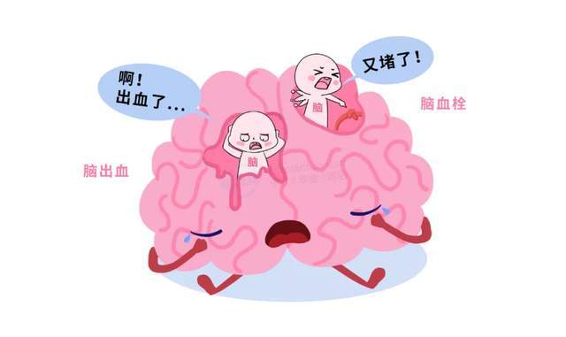 中风即脑卒中,包括脑出血和脑梗塞两大类,也就是脑血管破了和脑血管堵