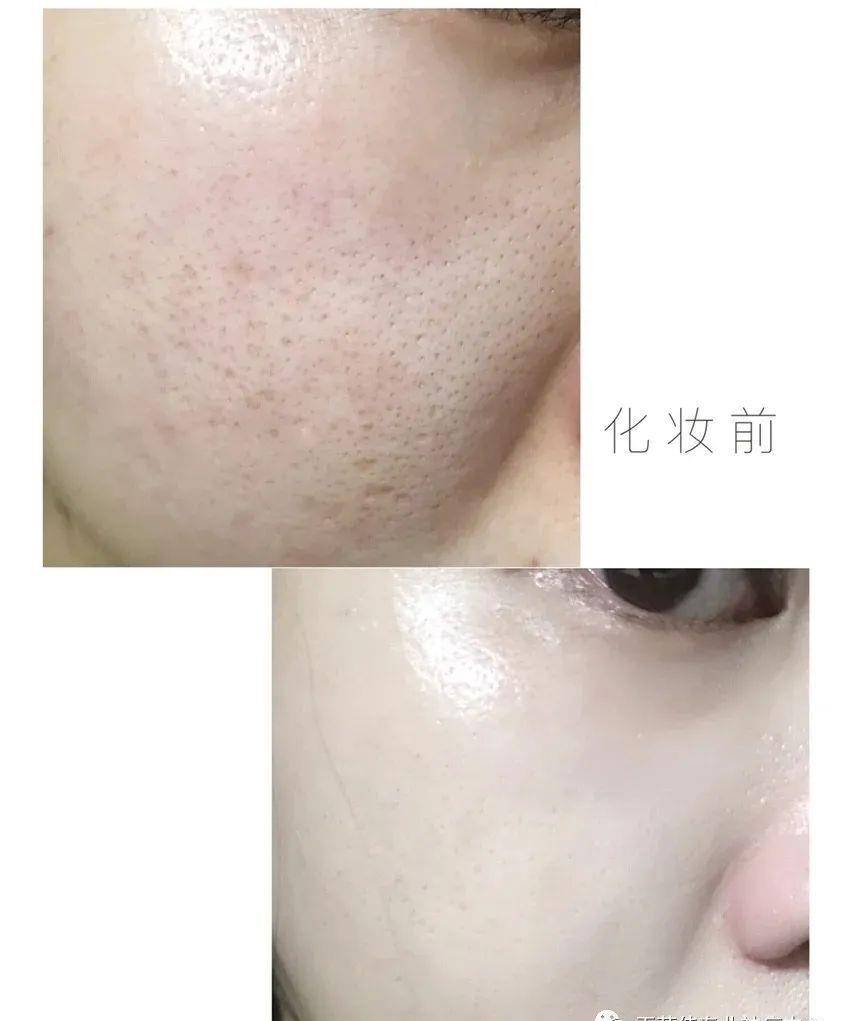 姐妹|痘痘肌化妆教程，小心机已经收藏了！