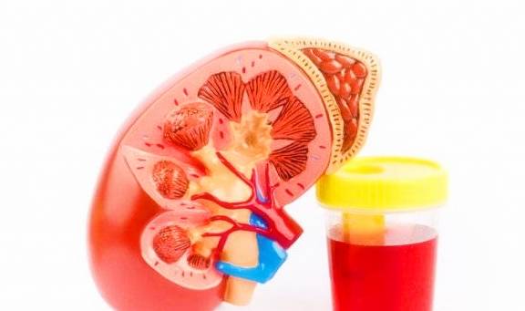 肾脏|为什么现在肾病人群越来越多？医生：有些食物爱吃的人越来越多了