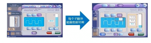 天津|天津联合丽格引进的第二台AOPT黄金超光子来了！快速打造嫩白牛奶肌