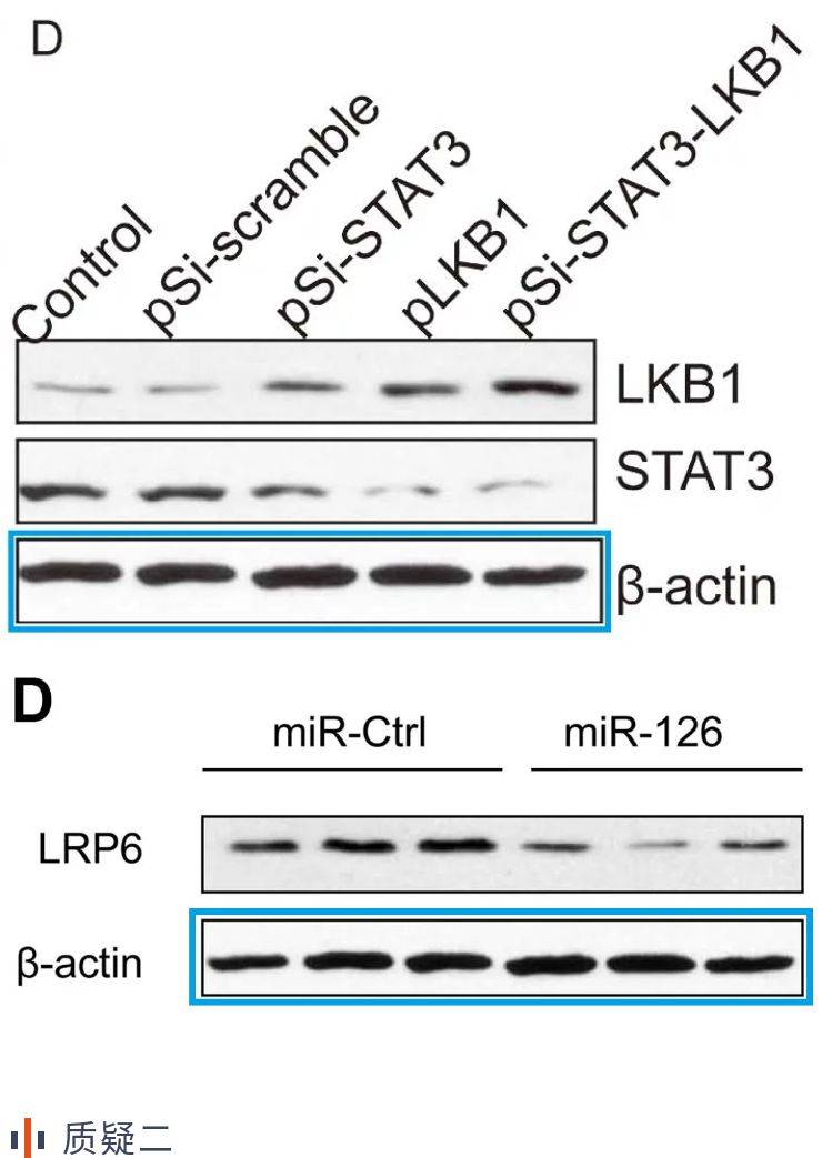 吉林大学第一医院sci论文与多篇文章图片重复被撤回_条带