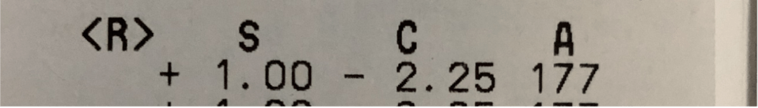 右眼|西安市第一医院｜医学科普：“散光”的理解