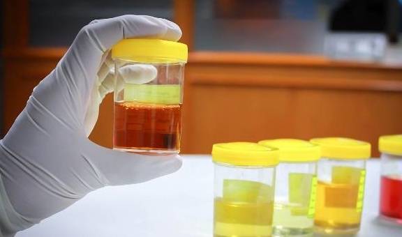 症状|提醒：糖尿病人有这6个表现，可能要考虑“糖尿病肾病”