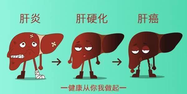 來跟和諧醫生王遠聊聊防治肝硬化的那些事