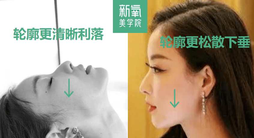 眉骨|给赵露思换了天使大宝贝的眉骨和眼眶骨，这张脸洋气指数飙升120%