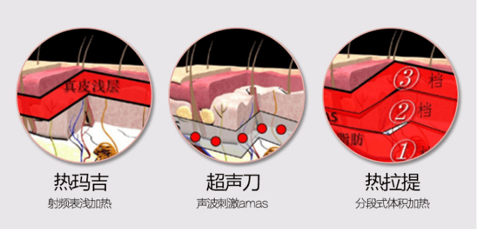 玛吉|扒一扒：热玛吉和热拉提哪个效果好？有没有副作用？