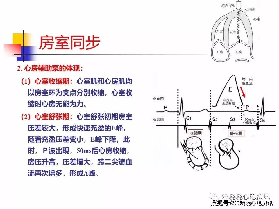 电-机械耦联与房室同步