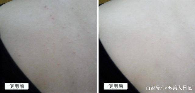因为|26岁昆凌美背撩人，上万衣裙藏不住凹凸感，俩娃妈不简单