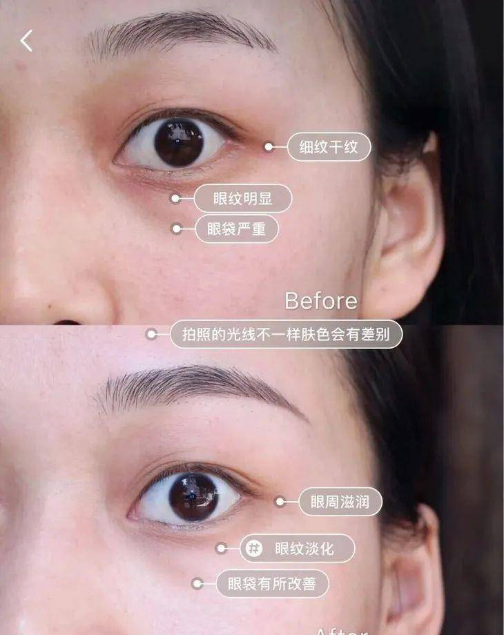 眼睛|眼部保养重在“润”！用它一喷好舒服，细纹慢慢膨了起来